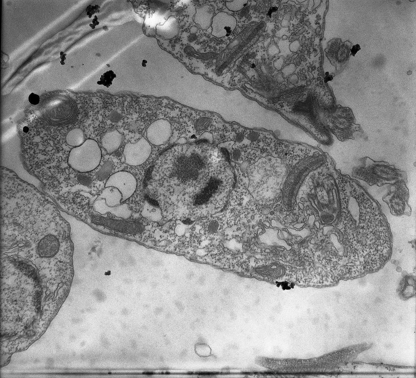 Describen un “arsenal silencioso” de la leishmaniasis visceral