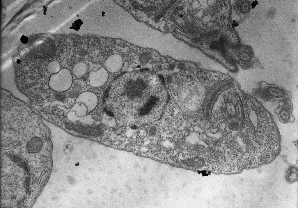 Describen un “arsenal silencioso” de la leishmaniasis visceral
